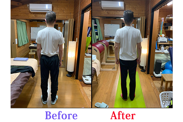 肘の痛みと肩の痛みが改善