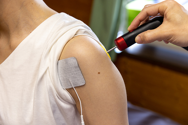 肩の電気刺激