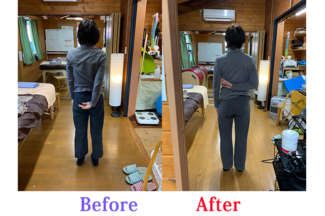 施術による結滞動作の変化